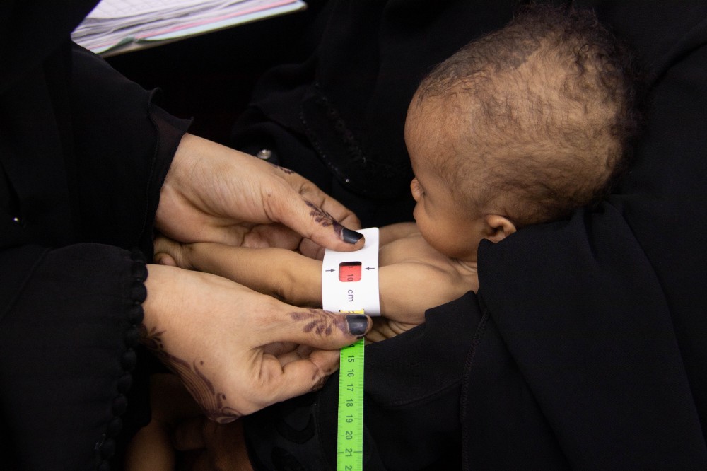 Child being checked for malnutrition