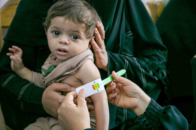  Yemen. Mohammed, 10 months, is checked for malnutrition by health worker Zahra at Al Shaheed hospital