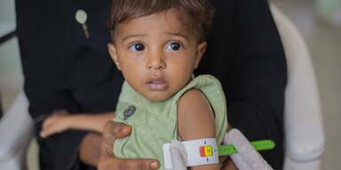 Child in Yemen having arm measured to assess level of malnutrition