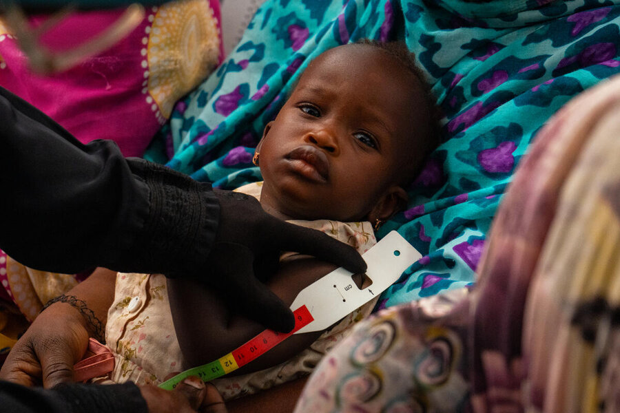 Child malnutrition in many parts of Sudan is worryingly high. Photo: Abubakar Garelnabei