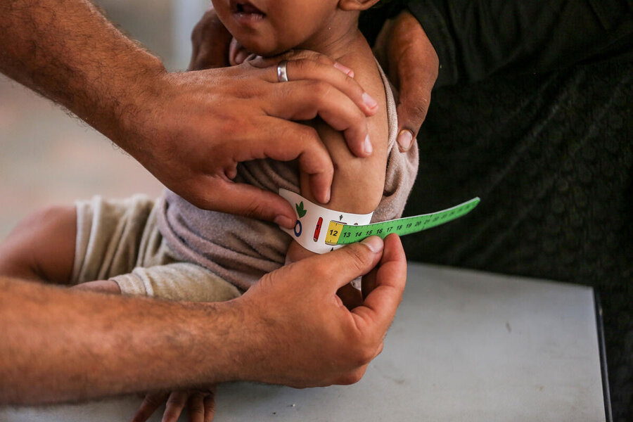 A child being tested for malnutrition in Gaza, where rates among young children are alarming. Photo: WFP/Ali Jadallah