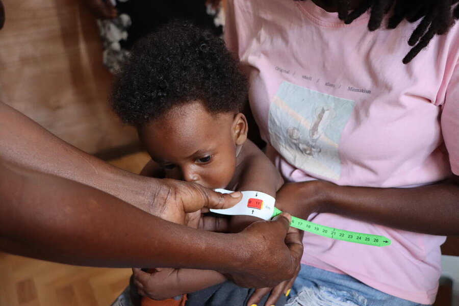 This infant shows signs of severe acute malnutrition during testing in Haiti. Photo: WFP/Alexis Masciarelli 