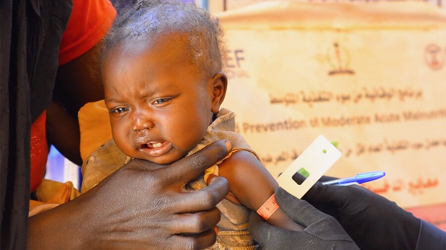 At Zamzam, a child is tested for malnutrition that affects mililons of children in Sudan. Photo: WFP/Mohamed Galal